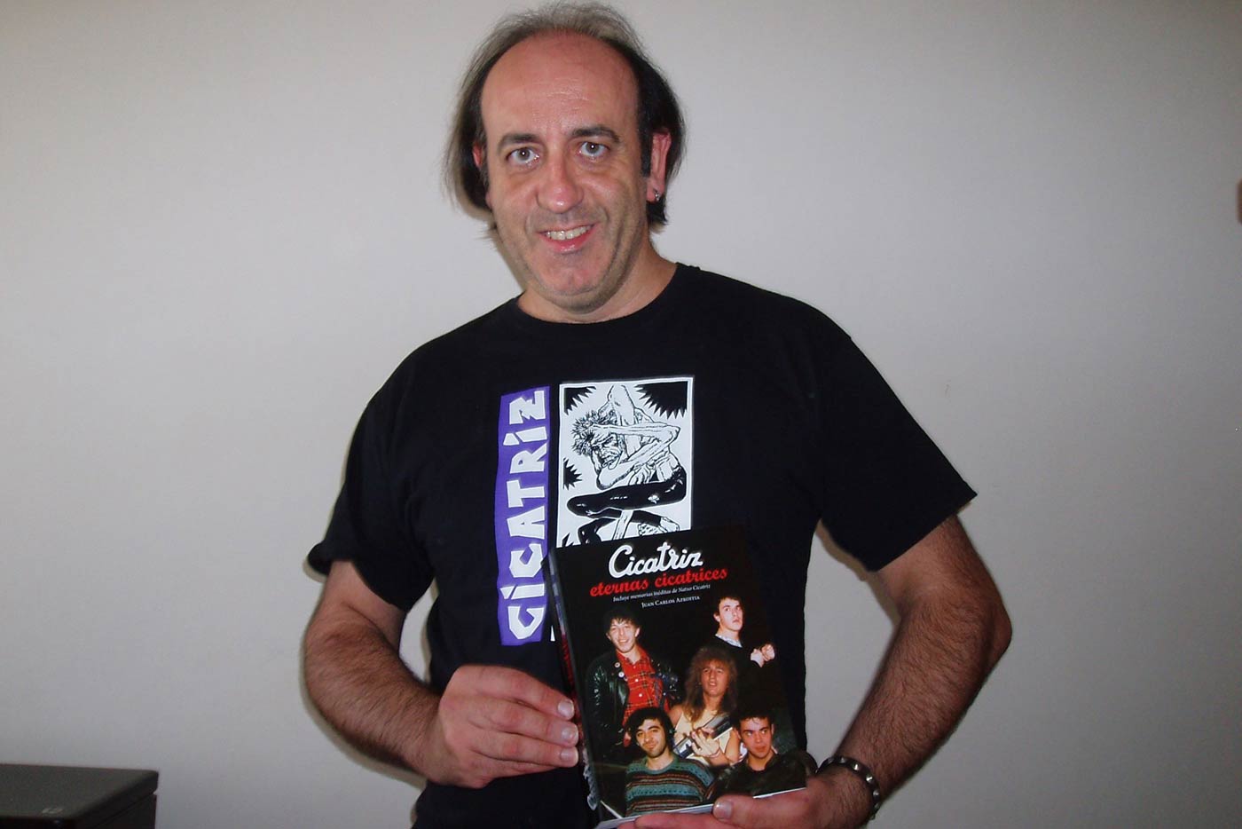 juan-carlos-azkoita-cicatriz