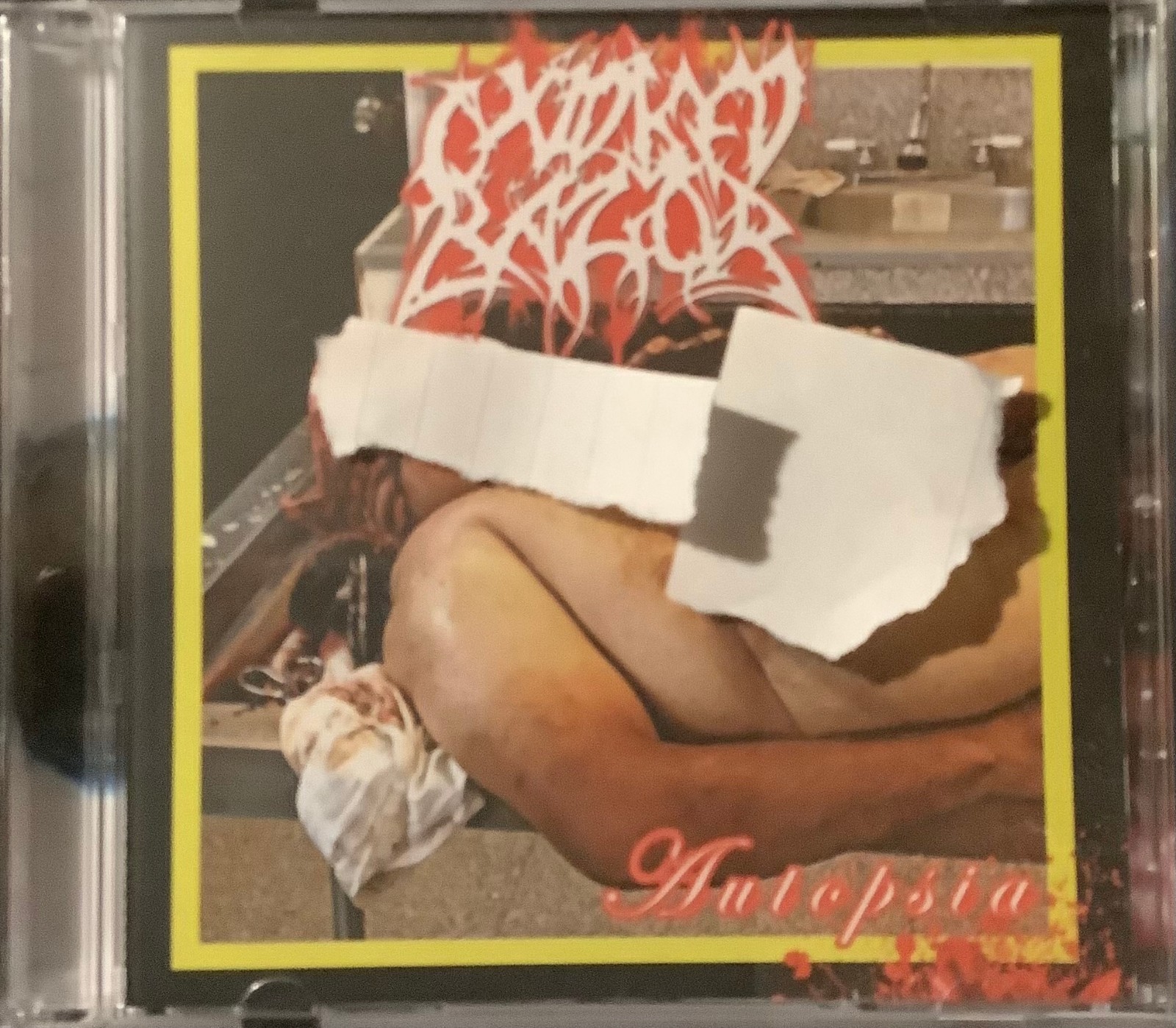 Fetal Deformity/Oxidised Razor - Autopsia Split CD(2025)NUNSLAUGHTER HAEMORRHAGE