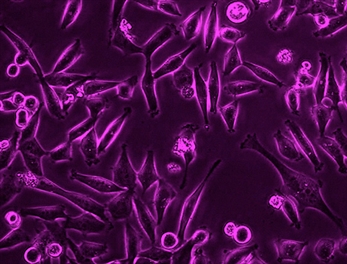 LABoral presenta la Exposición Danza infinita de Lorena Lozano