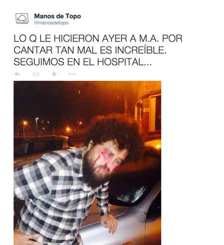 Manos de Topo informan sobre una supuesta paliza a su cantante